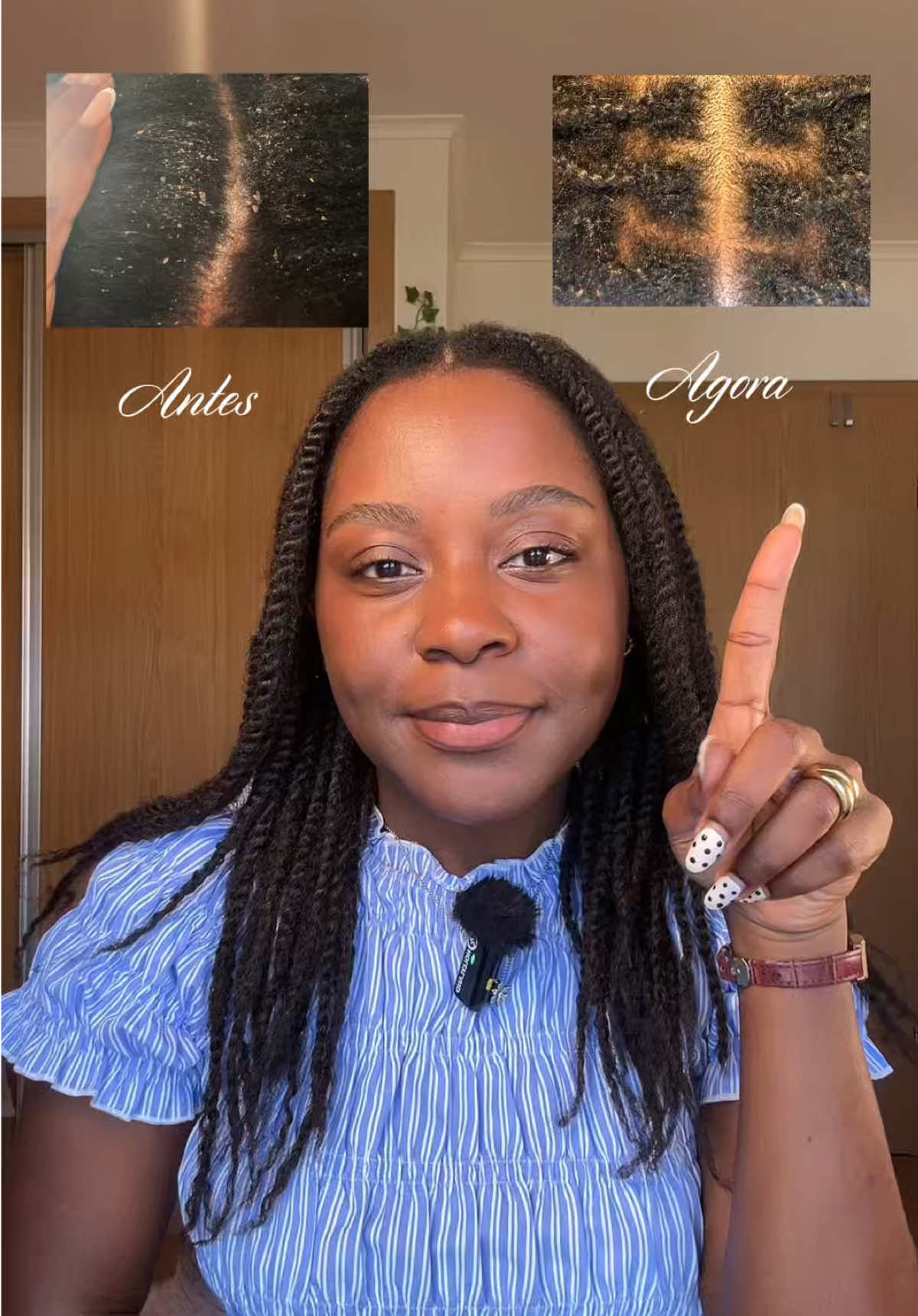 Cover frame from Sheila Chipupa’s Uriage DS Hair scalp-care video on TikTok